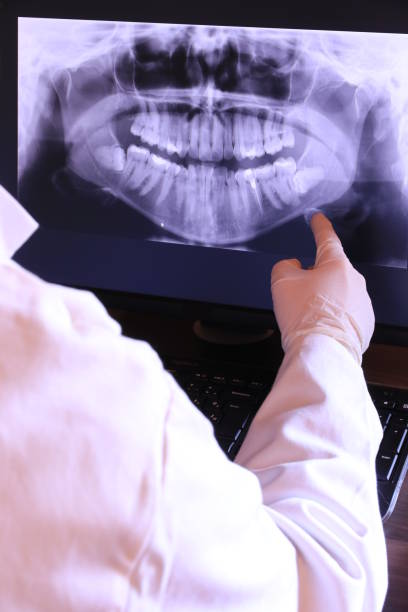 Best Emergency Tooth Extraction in Stansberry Lake, WA